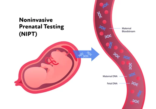 Image diagram for Non-invasive Prenatal Paternity test