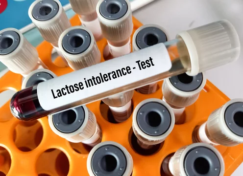 Image of blood sample tube for Lactose intolerance test